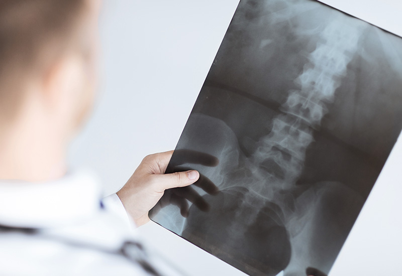 spinal cord injuries in calgary